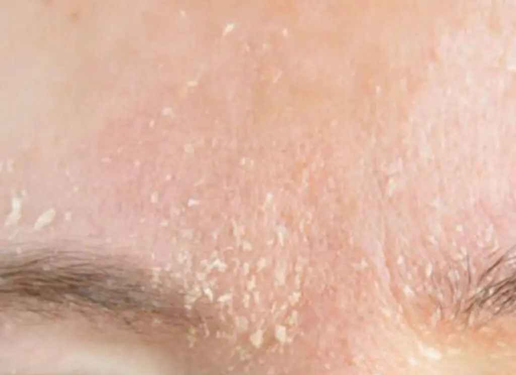 migliore crema viso pelle secca e sensibile